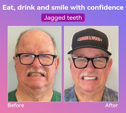 𝐉𝐚𝐬𝐬𝐞𝐞𝐦® Latest Premium Comfort Dentures🍀(High-End Dentures, Easy to Wear - Limited Time 70% Discount)