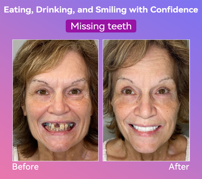 𝐉𝐚𝐬𝐬𝐞𝐞𝐦®👩‍⚕️🎁𝐍𝐞𝐱𝐭-𝐆𝐞𝐧 𝐂𝐨𝐦𝐟𝐨𝐫𝐭 𝐃𝐞𝐧𝐭𝐮𝐫𝐞(🦷𝐋𝐢𝐦𝐢𝐭𝐞𝐝 𝐭𝐢𝐦𝐞 𝐝𝐢𝐬𝐜𝐨𝐮𝐧𝐭 𝐋𝐚𝐬𝐭 𝟑𝟎 𝐦𝐢𝐧𝐮𝐭𝐞𝐬🦷)