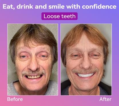 𝐉𝐚𝐬𝐬𝐞𝐞𝐦® Latest Premium Comfort Dentures🍀(High-End Dentures, Easy to Wear - Limited Time 70% Discount)