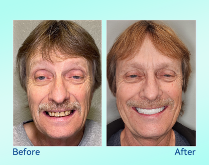 🔥 Only 4 boxes left! Enjoy an extra 50% off! Recommended by dentists, 🍀𝐁𝐢𝐤𝐞𝐧𝐝𝐚® ensures your oral health so you can enjoy meals safely and naturally. Don’t miss out—act now or wait until next year! Enhance your oral health today!