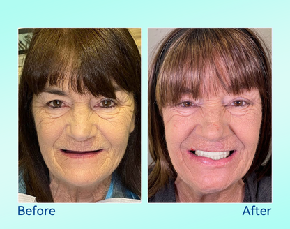 𝐁𝐢𝐤𝐞𝐧𝐝𝐚®🌍𝐏𝐫𝐞𝐦𝐢𝐮𝐦 𝐃𝐞𝐧𝐭𝐮𝐫𝐞(🦷𝐋𝐢𝐦𝐢𝐭𝐞𝐝 𝐭𝐢𝐦𝐞 𝐝𝐢𝐬𝐜𝐨𝐮𝐧𝐭 𝐋𝐚𝐬𝐭 𝟑𝟎 𝐦𝐢𝐧𝐮𝐭𝐞𝐬🦷)
