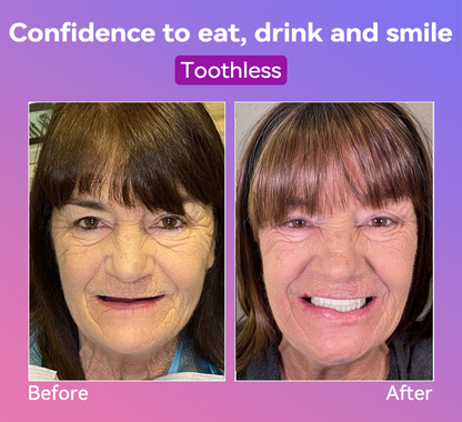 𝐉𝐚𝐬𝐬𝐞𝐞𝐦® Latest Premium Comfort Dentures🍀(High-End Dentures, Easy to Wear - Limited Time 70% Discount)