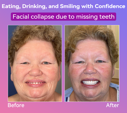 𝐉𝐚𝐬𝐬𝐞𝐞𝐦® Latest Premium Comfort Dentures🍀(High-End Dentures, Easy to Wear - Limited Time 70% Discount)