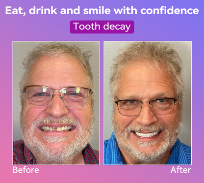 𝐉𝐚𝐬𝐬𝐞𝐞𝐦®👩‍⚕️🎁𝐍𝐞𝐱𝐭-𝐆𝐞𝐧 𝐂𝐨𝐦𝐟𝐨𝐫𝐭 𝐃𝐞𝐧𝐭𝐮𝐫𝐞(🦷𝐋𝐢𝐦𝐢𝐭𝐞𝐝 𝐭𝐢𝐦𝐞 𝐝𝐢𝐬𝐜𝐨𝐮𝐧𝐭 𝐋𝐚𝐬𝐭 𝟑𝟎 𝐦𝐢𝐧𝐮𝐭𝐞𝐬🦷)