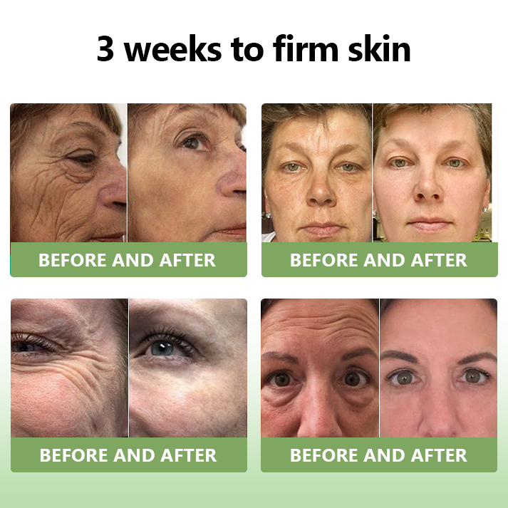 (Official Store) STDEI® 🎉 Natural Collagen Firming Cream - Year-End Sale 70% Off