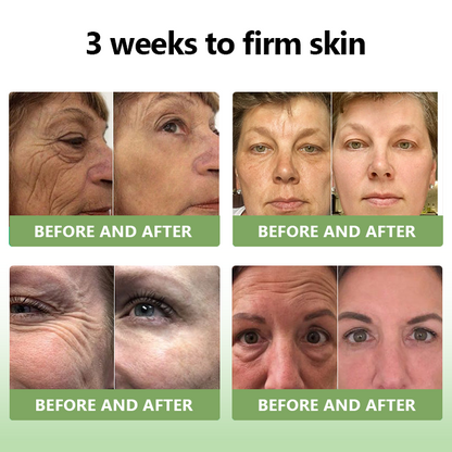 (Official Store) STDEI® 🎉 Natural Collagen Firming Cream - Year-End Sale 70% Off