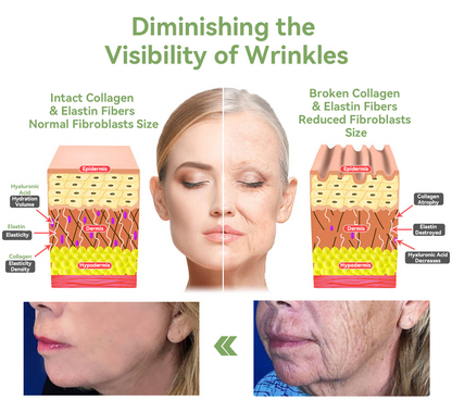 (Official Store) STDEI® 🎉 Natural Collagen Firming Cream - Year-End Sale 70% Off