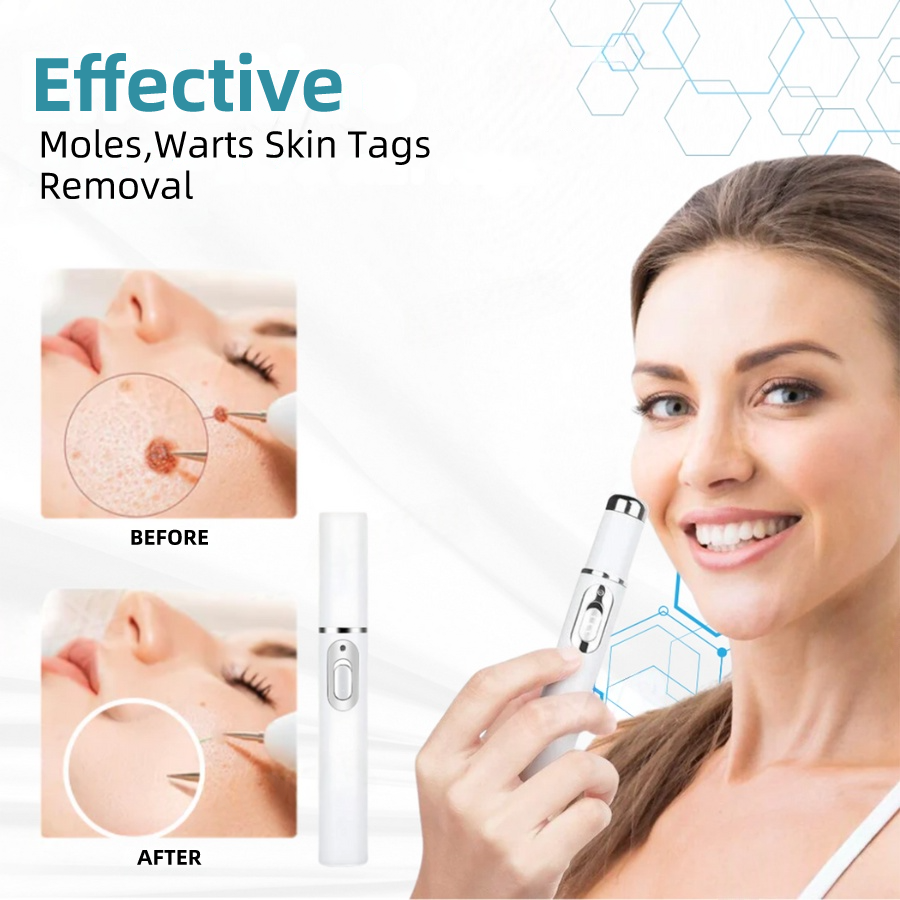 𝐉𝐚𝐬𝐬𝐞𝐞𝐦® Medical-Grade Laser Pen 🎉 (Powered by CO₂ laser technology – effectively removes moles, warts, skin tags, pigmentation spots, and other skin imperfections)🏆