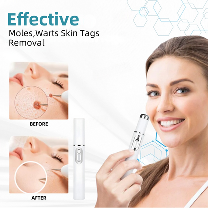 𝐉𝐚𝐬𝐬𝐞𝐞𝐦® Medical-Grade Laser Pen 🎉 (Powered by CO₂ laser technology – effectively removes moles, warts, skin tags, pigmentation spots, and other skin imperfections)🔥