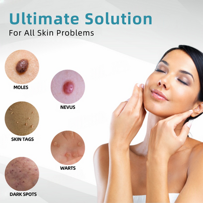 𝐉𝐚𝐬𝐬𝐞𝐞𝐦® Medical-Grade Laser Pen 🎉 (Powered by CO₂ laser technology – effectively removes moles, warts, skin tags, pigmentation spots, and other skin imperfections)🏆