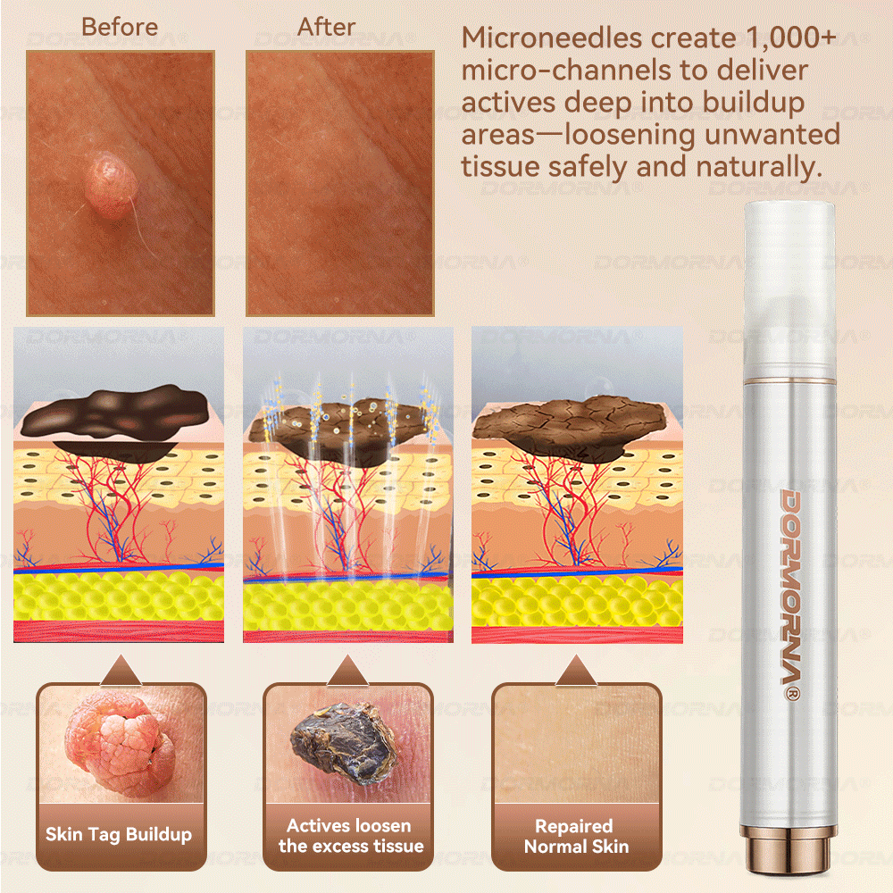 Dormorna® Stem Cell PDRN Repair Milk 💕 | With 2000PPM Exosome‑Coated Micro‑Spicules 🏆