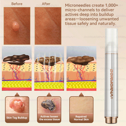 Dormorna® Stem Cell PDRN Repair Milk 💕 | With 2000PPM Exosome‑Coated Micro‑Spicules 🏆