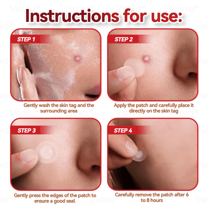 🛡️ 𝑉𝑠𝑜𝑥𝑎® 💕 Microneedle Botanical Skin Tag Repair Patches (Painless, scar‑free, fast removal of various blemishes and acne)👩‍⚕️