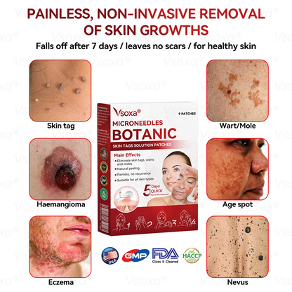 🛡️ 𝑉𝑠𝑜𝑥𝑎® 💕 Microneedle Botanical Skin Tag Repair Patches (Painless, scar‑free, fast removal of various blemishes and acne)👩‍⚕️