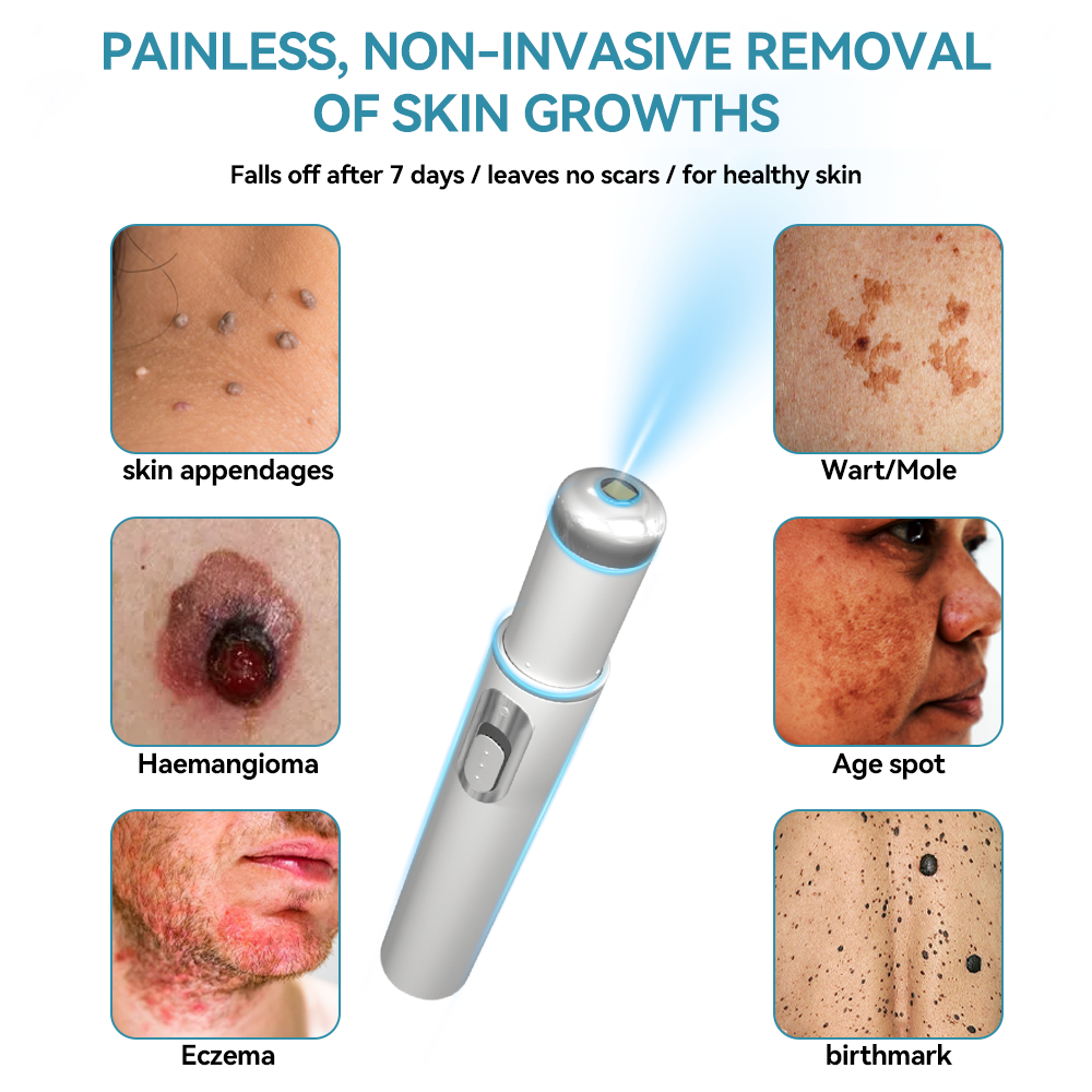 𝐉𝐚𝐬𝐬𝐞𝐞𝐦® Medical-Grade Laser Pen 🎉 (Powered by CO₂ laser technology – effectively removes moles, warts, skin tags, pigmentation spots, and other skin imperfections)🏆