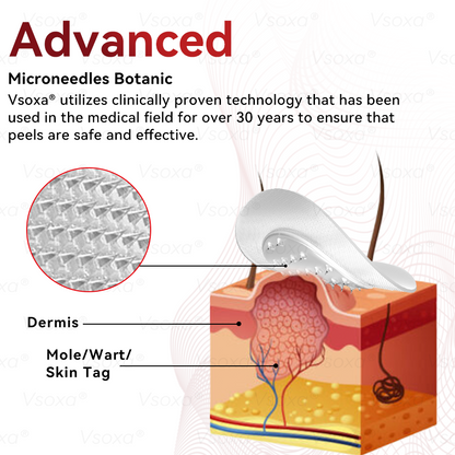 🛡️ 𝑉𝑠𝑜𝑥𝑎® 💕 Microneedle Botanical Skin Tag Repair Patches (Painless, scar‑free, fast removal of various blemishes and acne)👩‍⚕️