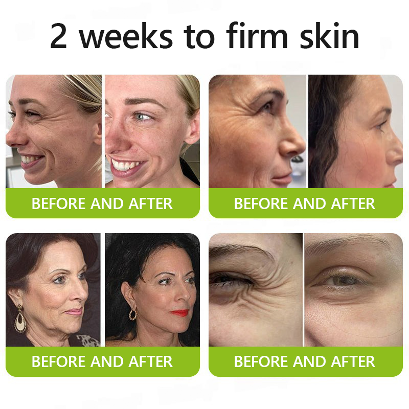 Official Store | Rejuvenate Your Skin Instantly 💫 STDEI® BOTOX & VITA A RETINOL SHOT Anti-Wrinkle Lifting & Firming Cream