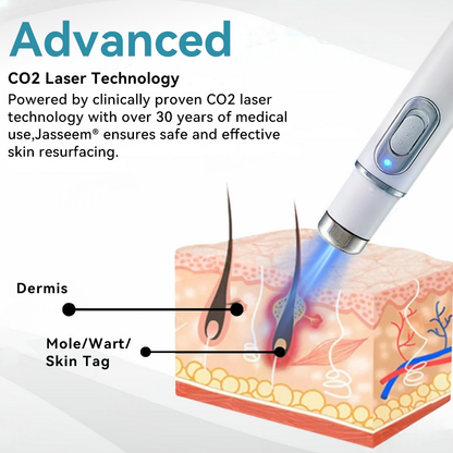 𝐉𝐚𝐬𝐬𝐞𝐞𝐦® 🧡Non-invasive Mole and Wart Removal Laser Pen (Quick and painless removal of warts, moles, age spots and skin tags - without any side effects)