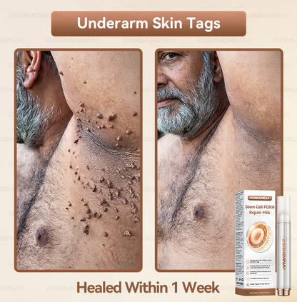 𝐷𝑂𝑅𝑀𝑂𝑅𝑁𝐴® 💕 Stem Cell PDRN Repair Milk | With 2000PPM Exosome‑Coated Micro‑Spicules 👩‍⚕️